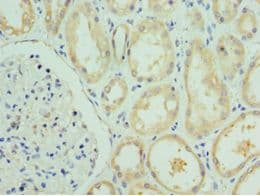 VIPERIN / RSAD2 Antibody (aa42-361)