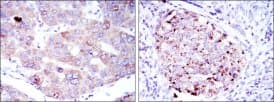 EEF2 / Elongation Factor 2 Antibody (clone 5B6)