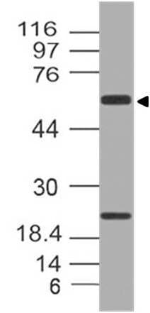 Alpha-1-Antichymotrypsin Antibody