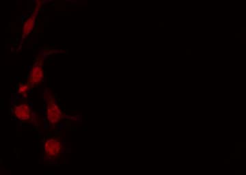 TFB1 / GTF2H1 Antibody