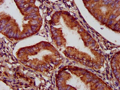 Polyclonal Rabbit anti-Human NADK2 / C5orf33 Antibody (IHC, WB)