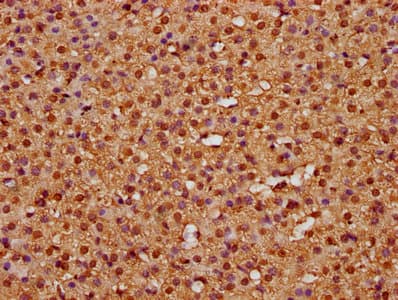 Polyclonal Rabbit anti-Human HIST1H3A Antibody (IHC)