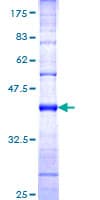 Human HECTD1 Protein (Recombinant GST, N-terminus)