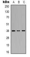 MAPK14 / p38 Antibody (C-Terminus)