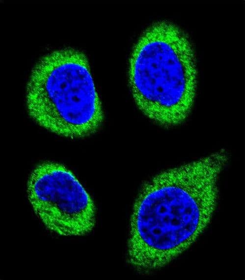 Polyclonal Rabbit anti-Human AGBL5 Antibody (aa99-127, IHC, IF, WB)