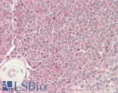 SLC16A1 / MCT1 Antibody (aa215-264)