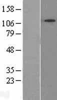 SNX13 Protein (Over-Expression Lysate Myc-DDK (Flag))