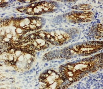 CTNNB1 / Beta Catenin Antibody (aa764-781)