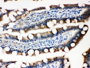 SERPINB5 / Maspin Antibody (aa1-350)