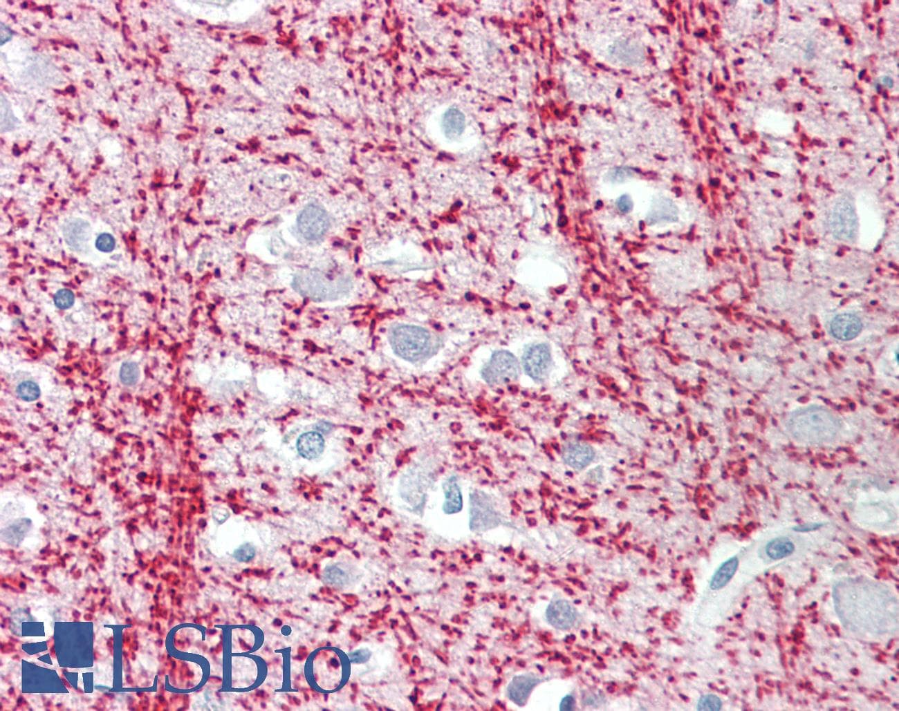 IHC-plus™ TPPP Antibody (aa21-35)