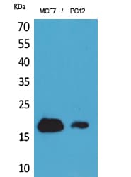 CD225 / IFITM1 Antibody