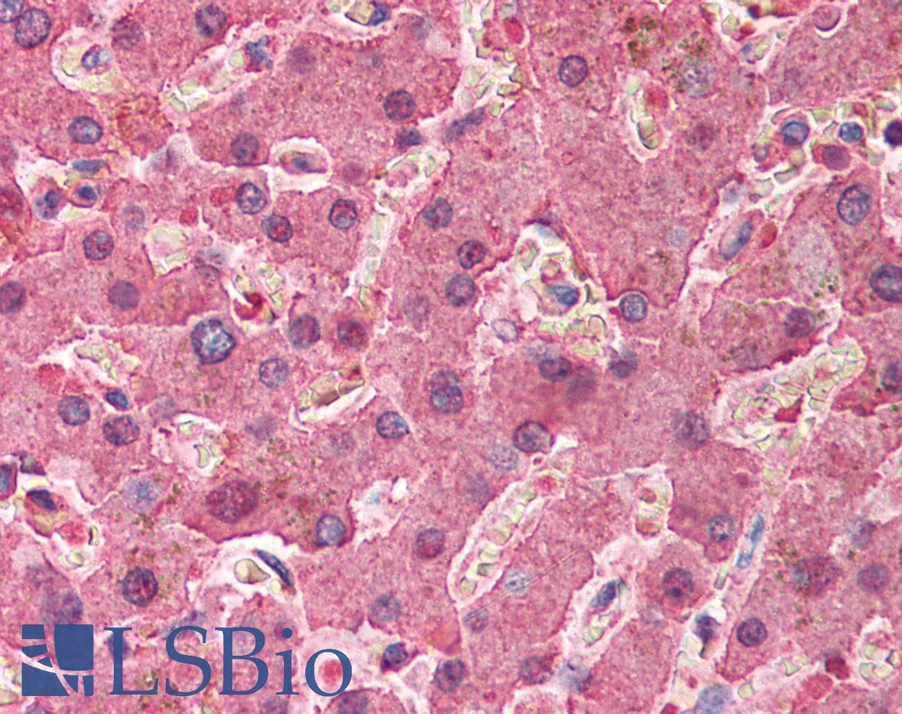 IHC-plus™ Polyclonal Rabbit anti-Human SERPINA1 / Alpha 1 Antitrypsin Antibody (IHC, WB)