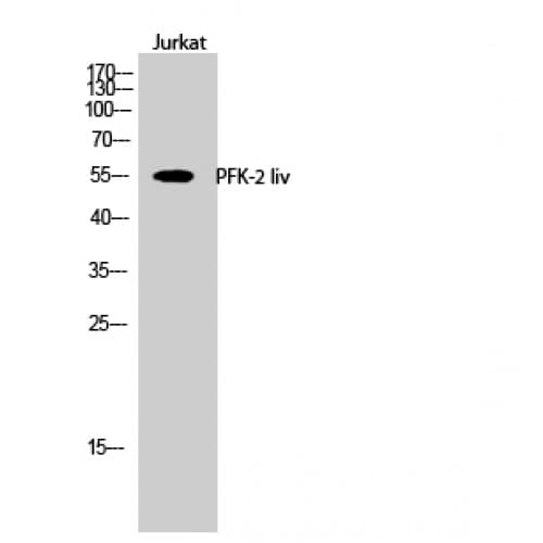 PFKFB1 Antibody (380-460 aa, C-terminal)