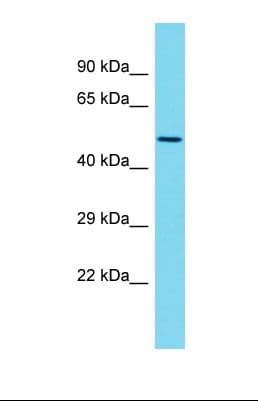 Polyclonal Rabbit anti-Human MRPS5 Antibody (aa105-154, WB)
