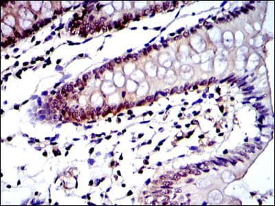 PSMB8 / LMP7 Antibody (clone 1A5)