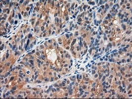 AMY2A / Pancreatic Amylase Antibody (clone OTI6D4)