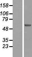 HDAC9 Protein (Over-Expression Lysate Myc-DDK (Flag))
