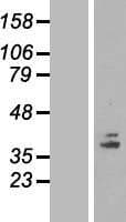 COQ5 Protein (Over-Expression Lysate Myc-DDK (Flag))