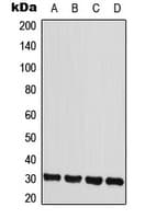 IL-22BP / IL22RA2 Antibody (Internal)