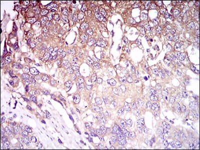 C1qRP / CD93 Antibody (aa474-535, clone 2F7D11)
