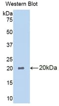 PSPLA1 / Phospholipase A1 Antibody (aa309-452, Biotin)