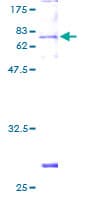 Human CPA1 / Carboxypeptidase A Protein (Recombinant GST)