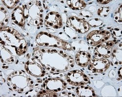 Monoclonal Mouse anti-Human ACLY / ATP Citrate Lyase Antibody (clone 3G8, Carrier-free, IHC, IF, WB)