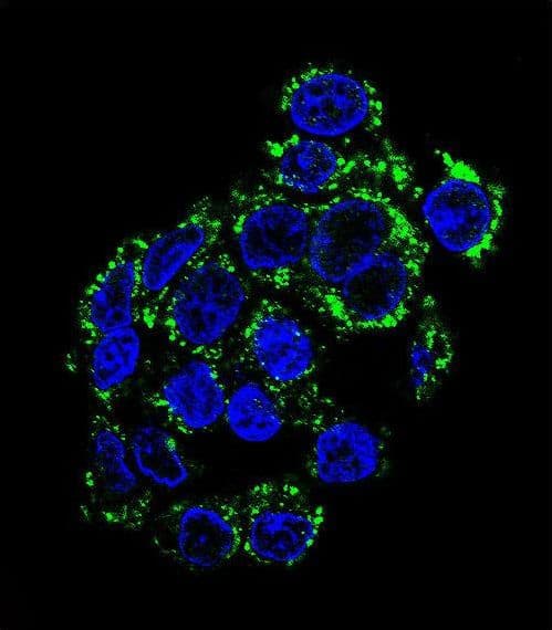PCK2 / PEPCK Antibody (aa24-54)