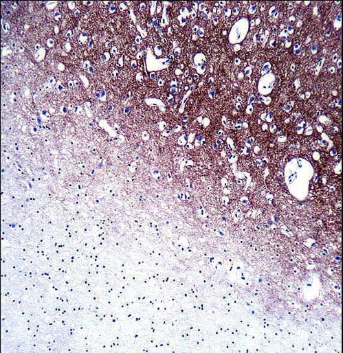 Polyclonal Rabbit anti-Human SYP / Synaptophysin Antibody (aa225-253, IHC, IF, WB)