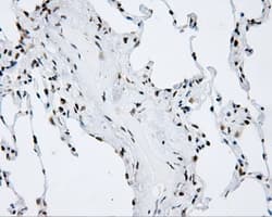 p66 / SHC Antibody (clone OTI3A1)