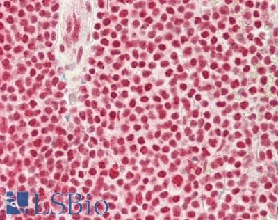 IHC-plus™ SET / TAF-I Antibody (aa47-75)