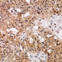 Polyclonal Rabbit anti-Human NDRG3 Antibody (IHC, WB)