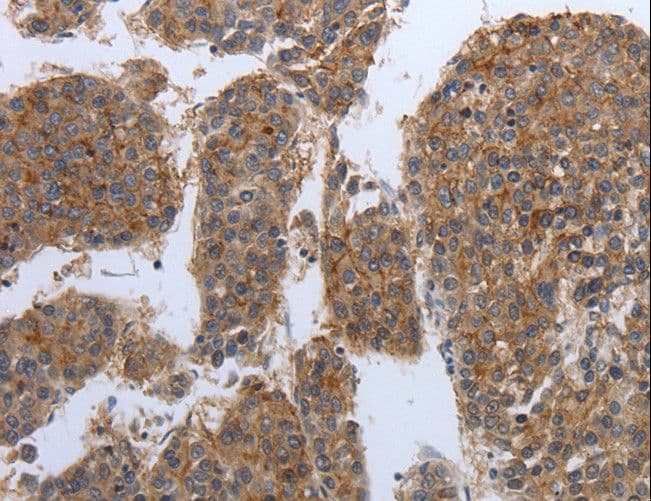 PDIA2 Antibody