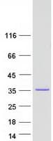 Human ZFAND1 Protein (Recombinant Myc-DDK (Flag))