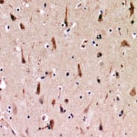 ACVR1C / ALK7 Antibody