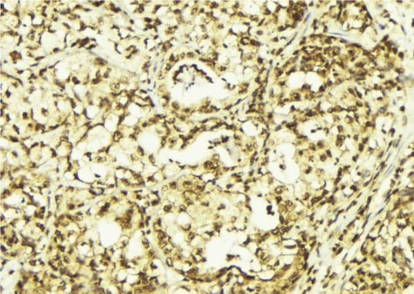 Polyclonal Rabbit anti-Human HSPB6 / HSP20 Antibody (IHC, IF, WB)