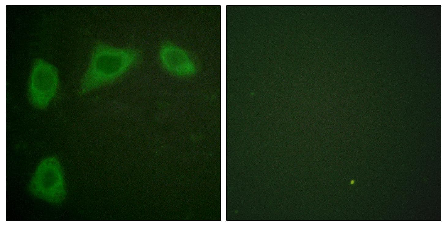 CAV1 / Caveolin 1 Antibody