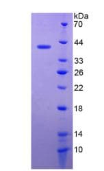 Human DEFB119 Protein (Recombinant His-GST)
