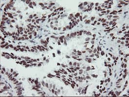 Monoclonal Mouse anti-Human SENP2 Antibody (clone OTI1H2, IHC, IF, WB)
