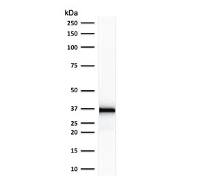 EMD / Emerin Antibody (clone EMD/2167)
