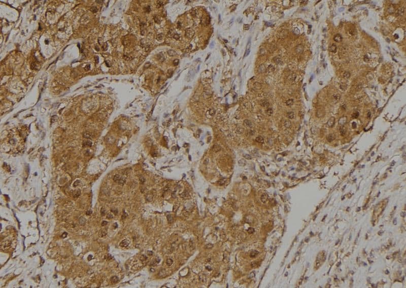 CCDC102B Antibody