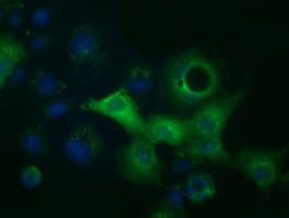 ACAT2 Antibody (clone OTI3A8)