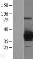 SULT4A1 / Sulfotransferase 4A1 Protein (Over-Expression Lysate Myc-DDK (Flag))
