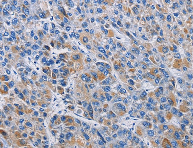 RICTOR Antibody