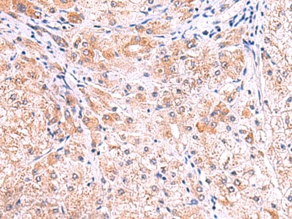 Polyclonal Rabbit anti-Human SMPD2 Antibody (IHC, WB)