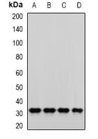 PNP / Nucleoside Phosphorylase Antibody