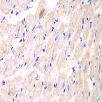 YWHAQ / 14-3-3 Theta Antibody