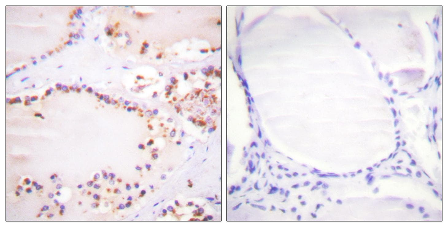 Polyclonal Rabbit anti-Human ETK / BMX Antibody (Tyr566, IHC, IF, WB)