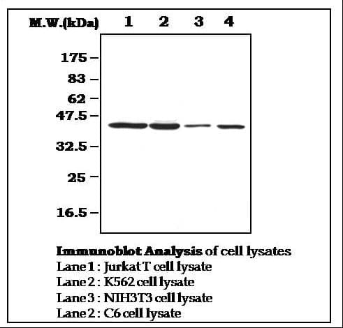 IHC-plus™ Monoclonal Mouse anti-Human CSNK2A1 Antibody (IHC, WB)