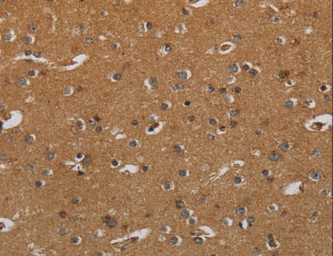 HSD17B2 Antibody